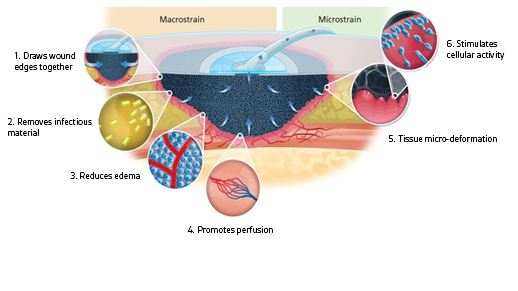 Macrostrain - Role Of Negative Pressure Wound Therapy In Pet Wound Therapy - Pet Care Supplies Blog